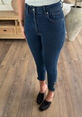 Paçası düğmeli skinny jean