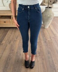 Paçası düğmeli skinny jean